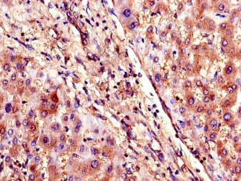 SLCO1B3 / OATP8 Antibody