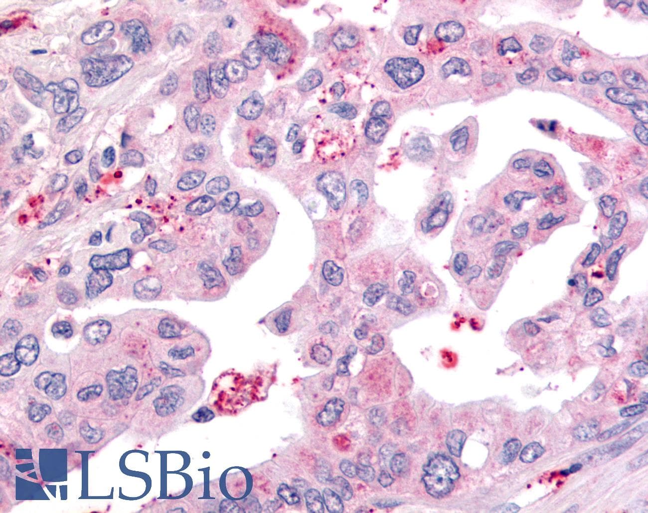 IHC-plus™ Polyclonal Rabbit anti-Human USP4 Antibody (Internal, IHC)