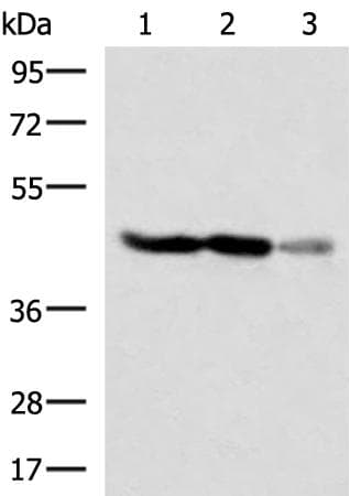 FDFT1 / Squalene Synthase Antibody