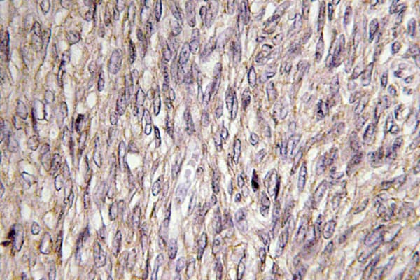 FGF22 Antibody (Ala96)