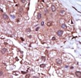 ACVRL1 Antibody (aa474-503)