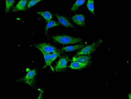 HPX / Hemopexin Antibody