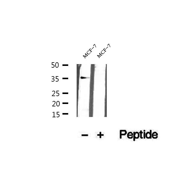 KCTD12 Antibody