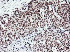 RNF113B Antibody (clone OTI2C10, Carrier-free)
