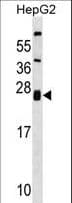 ZNRF1 Antibody (aa59-86)
