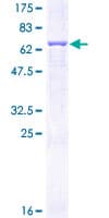 Human SERPINE1 / PAI-1 Protein (Recombinant GST)