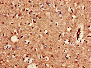 KCNJ3 / GIRK1 Antibody