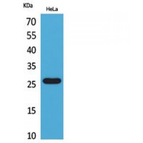 CD302 Antibody (81-130 aa, Internal)