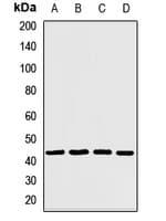 CAMK1D Antibody