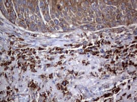 Monoclonal Mouse anti-Human PIK3C2A Antibody (clone OTI2D9, aa230-560, IHC, WB)