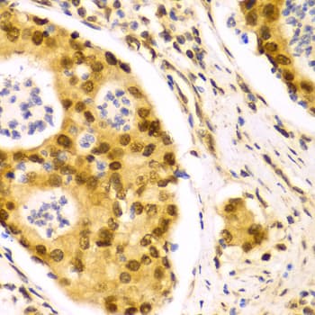 ELAVL1 / HUR Antibody