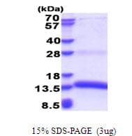 Human MZB1 Protein (Recombinant His)