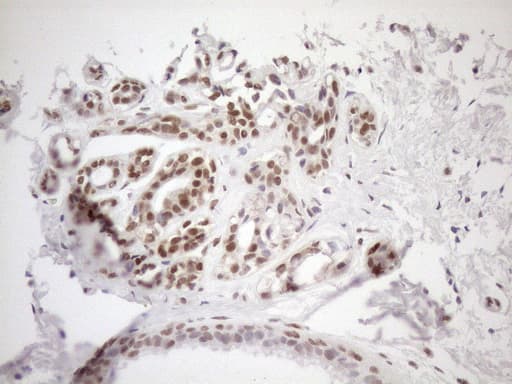 MGMT Antibody (clone OTI6C4)