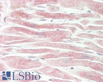IHC-plus™ Polyclonal Rabbit anti-Human CALB2 / Calretinin Antibody (aa201-250, IHC, WB)