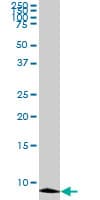 ATOX1 Antibody (clone 2E6)