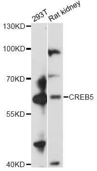 Polyclonal Rabbit anti-Human CREB5 Antibody (WB)