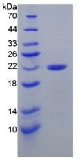 Mouse CALR / Calreticulin Protein (Recombinant His)