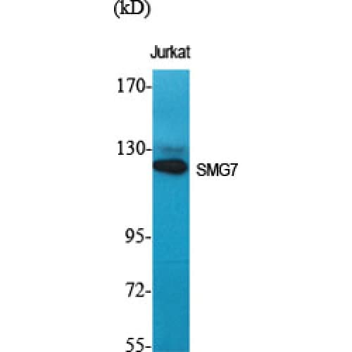 SMG7 Antibody (490-570 aa, Internal)