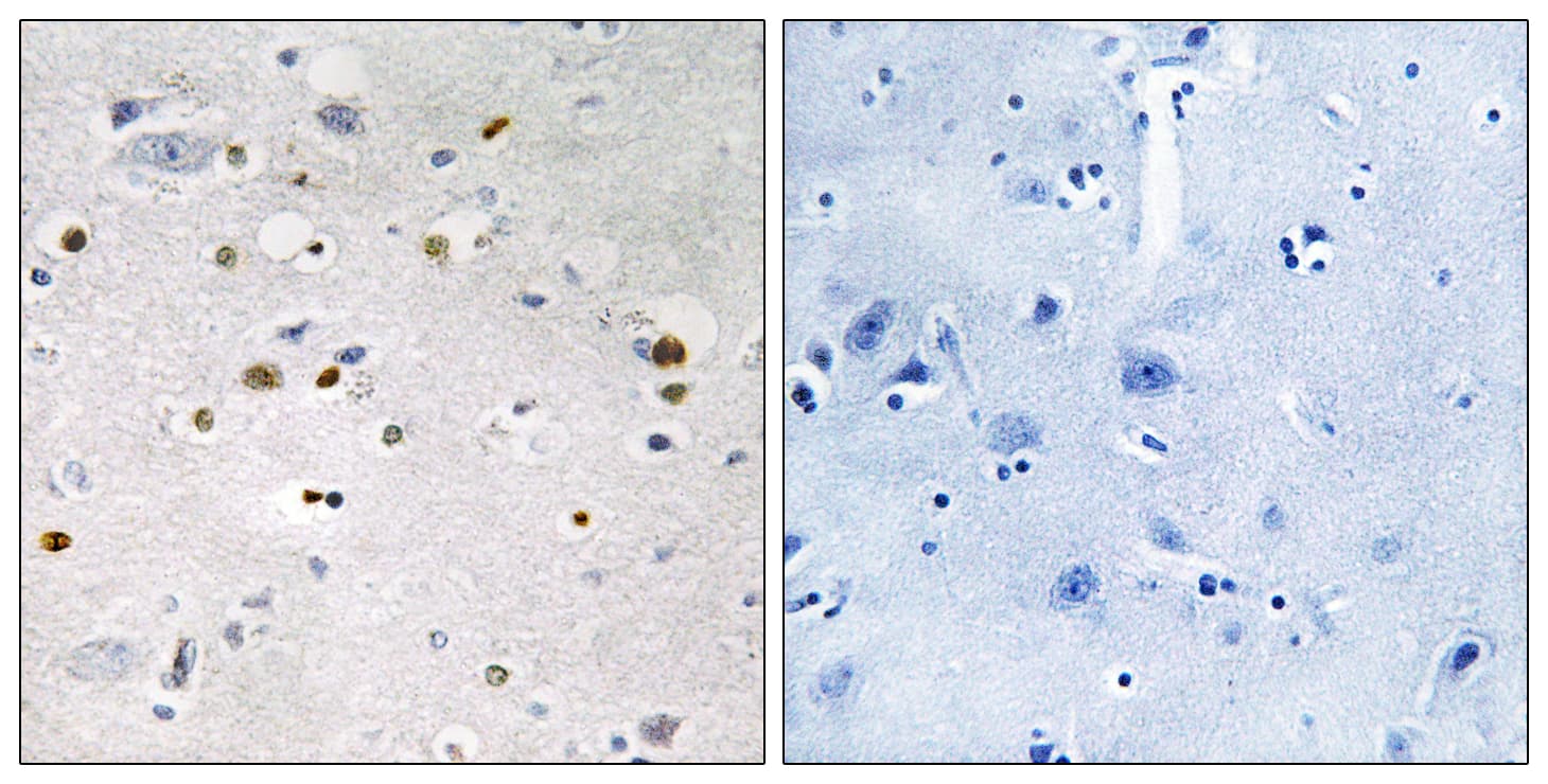 Polyclonal Rabbit anti-Human ZNF7 Antibody (aa41-90, IHC, IF)