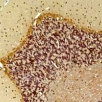 SLC6A1 / GAT-1 Antibody