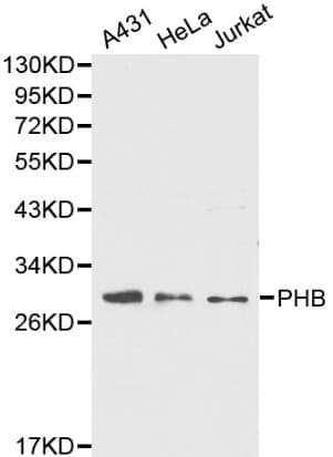 Polyclonal Rabbit anti-Human PHB / Prohibitin Antibody (IHC, WB)