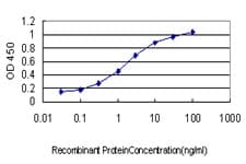 UBTF / UBF Antibody (clone 6B6)