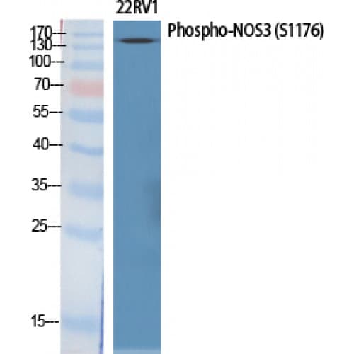 NOS3 / eNOS Antibody (1110-1190 aa)