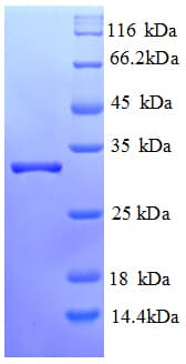 Human LBA / LRBA Protein (Recombinant His)