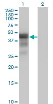 Monoclonal Mouse anti-Human DMRT1 Antibody (clone 1G11, WB)