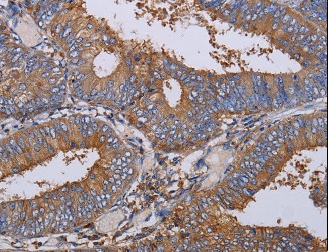 Polyclonal Rabbit anti-Human LIMS1 / PINCH Antibody (IHC, WB)