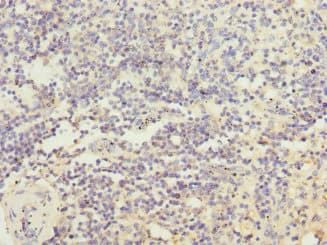 Polyclonal Rabbit anti-Human IL21 Receptor Antibody (IHC, WB)