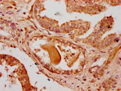 Polyclonal Rabbit anti-Human RNF220 / C1orf164 Antibody (IHC)