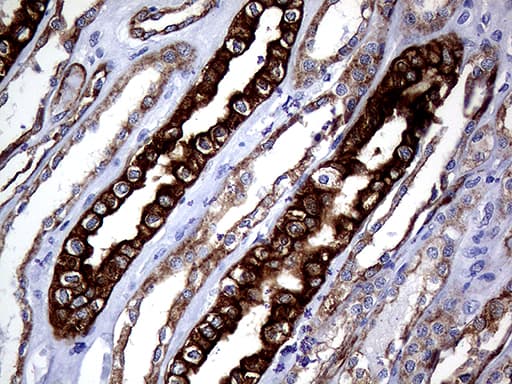 KRT8 / CK8 / Cytokeratin 8 Antibody (aa91-381, clone OTI2F5)