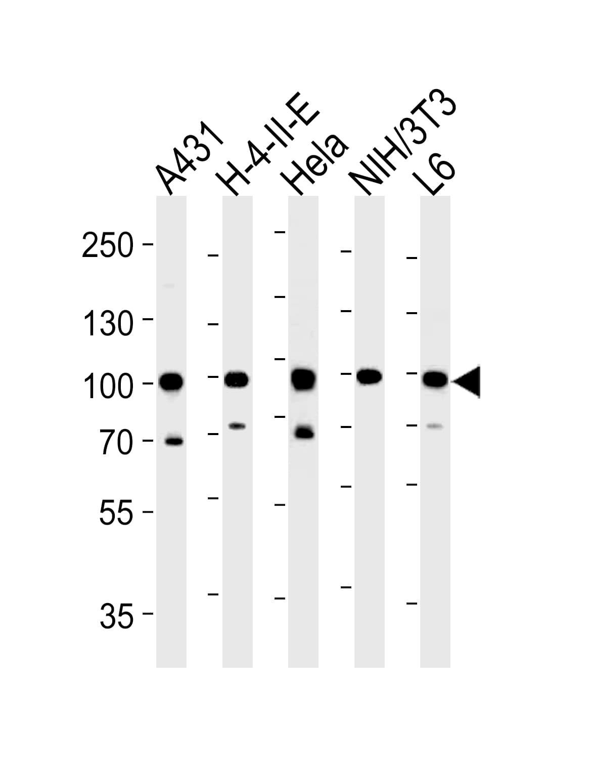 Polyclonal Rabbit anti-Human HSP90AB1 / HSP90 Alpha B1 Antibody (aa697-724, IHC, WB)
