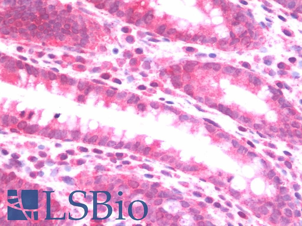 IHC-plus™ HIF2A / EPAS1 Antibody (clone EP190b)