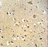 OGT / O-GLCNAC Antibody (aa1017-1046)