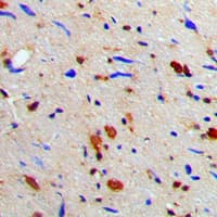 Polyclonal Rabbit anti-Human RACGAP1 / MGCRACGAP Antibody (N-Terminus, IHC, IF, WB)