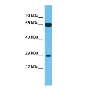 C15orf33 Antibody (aa90-139)