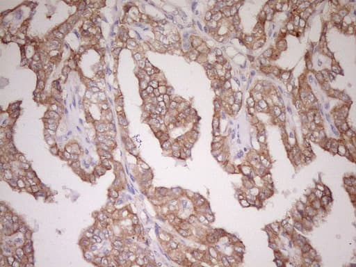 CDH1 / E Cadherin Antibody (clone UMAB184)