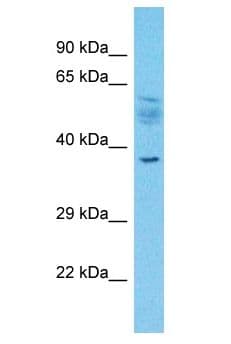 SLC2A4RG / GEF Antibody (aa1-50)