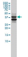IHC-plus™ SH3GLB1 / Bif / Endophilin B1 Antibody (clone 1B3-A5)