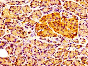 CCKAR / CCK1R Antibody