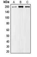 Polyclonal Rabbit anti-Human CDC42BPA / MRCK Antibody (Internal, WB)