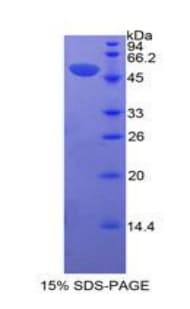 Human EPOR / EPO Receptor Protein (Recombinant His-GST)