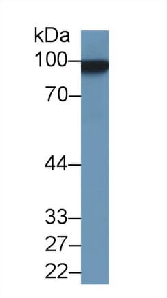 MCAM / CD146 Antibody (aa323-560, APC)