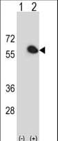 Polyclonal Rabbit anti-Human FKBP4 / FKBP52 Antibody (aa186-216, IHC, WB)