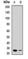 EXOSC4 / RRP41 Antibody
