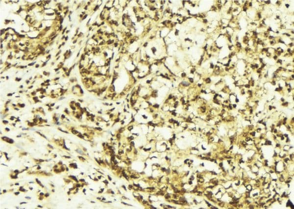 PRKCD / PKC-Delta Antibody (phospho-Tyr313)