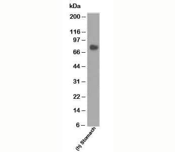 CEA / Carcinoembryonic Antigen Antibody (clone COL-1, Ready-to-Use)