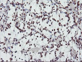 FMR1 / FMRP Antibody (clone OTI1C6)